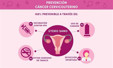 Cancer De Cervix