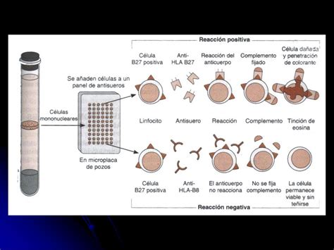 Técnicas inmunológicas y moleculares para la determinación de