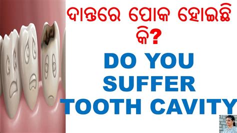 ଦାନ୍ତ ପୋକ ଖାଇଛି କି Odia Odia Home Remedies How To Get Rid Of Tooth