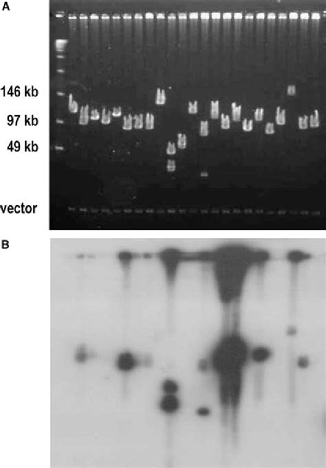 The Pulsed Field Gel Electrophoresis Pfge Analysis Of Bacterial