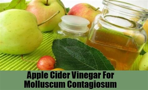 Top 5 Home Remedies For Molluscum Contagiosum Natural Treatments For Molluscum Contagiosum