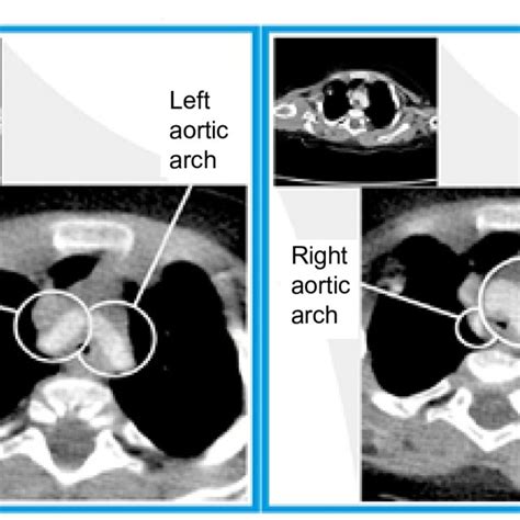 Contrast Enhanced Computerized Tomography Axial Section Image Showing Download Scientific