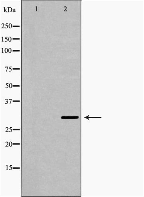 Carbonic Anhydrase I Polyclonal Antibody Invitrogen L