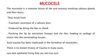 Mucocele and Renula | PPT