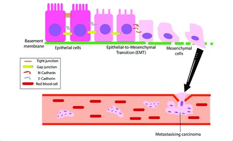 Epithelial Mesenchymal Transition Cancer