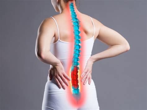 Spondylolisthesis Physical Therapy Exercises