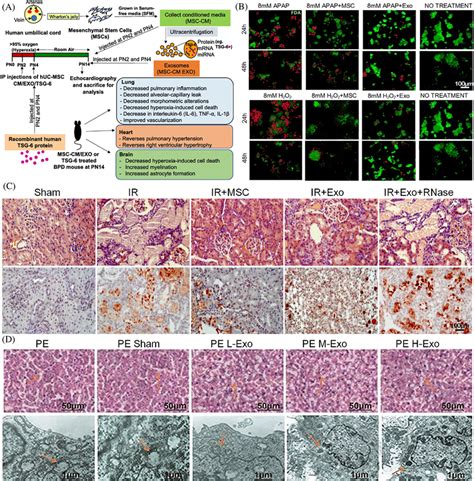 MSCExos In Visceral Disease Treatment A Schematic Representation Of