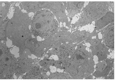 Electron Micrograph Of Porcine Nic Aggregates After Nine Days Culture