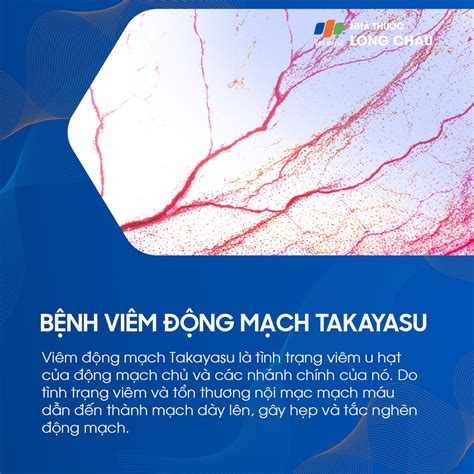 benh viem dong mach takayasu la gi nguyen nhan trieu chung va cach