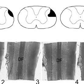 Schematic drawings and associated photomicrographs illustrating the ... 
