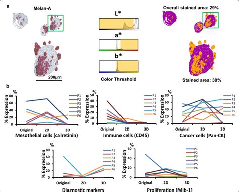 Quantification of IHC staining. a Digitalised image analysis approach ...
