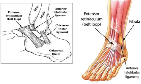 Ankle Instability - Drwolgin