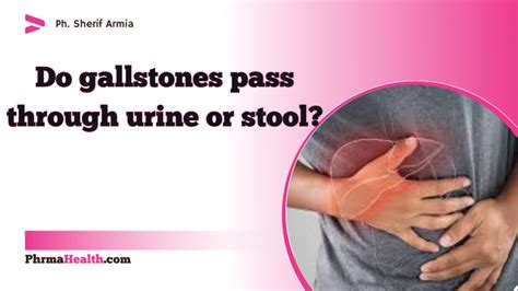 Passing A Gallstone How Does It Feel Phrmahealth