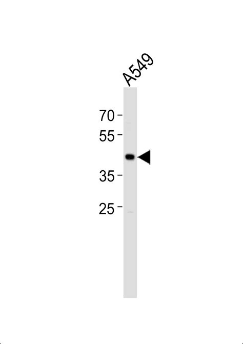 TGIF1 Antibody N Term Affinity Purified Rabbit Polyclonal Antibody