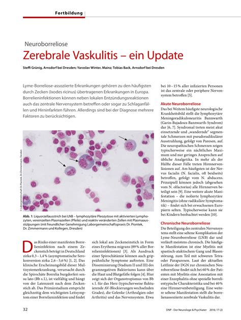 Pdf Zerebrale Vaskulitis Ein Update