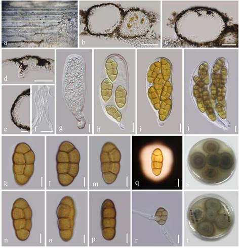 Sexual Morph Of Yunnanensis Phragmitis Mflu 17 0357 Holotype A