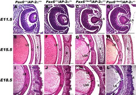 Pax Lacz Ap Embryonic Mouse Eyes Histological Sections