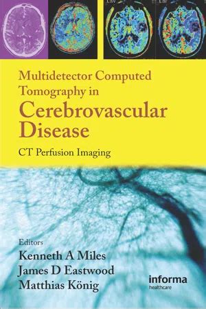 Pdf Multidetector Computed Tomography In Cerebrovascular Disease By