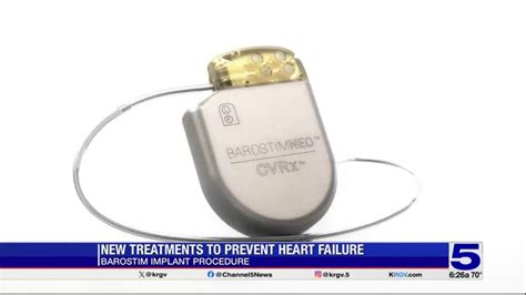 Medical Breakthroughs Barostim Implant Procedure To Prevent Heart Failure