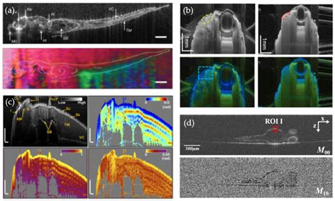 Bioengineering Free Full Text Optical Coherence Tomography Is A