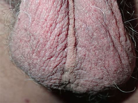 My Penis Up Close 20 Nude Pics XHamster