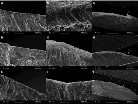 Electron micrographs of the enamel. The images were obtained via ...