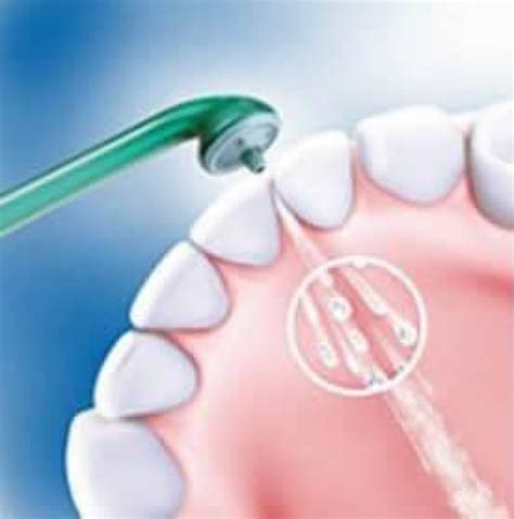 Qu Es Un Irrigador Dental Irrigador Dental