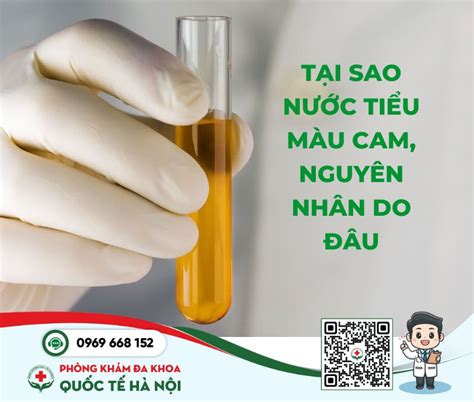 Nước tiểu màu cam Dấu hiệu bình thường hay cảnh báo sức khỏe Bác sĩ