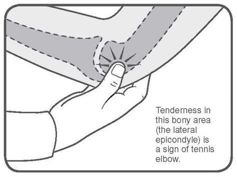 Tennis Elbow Treatment