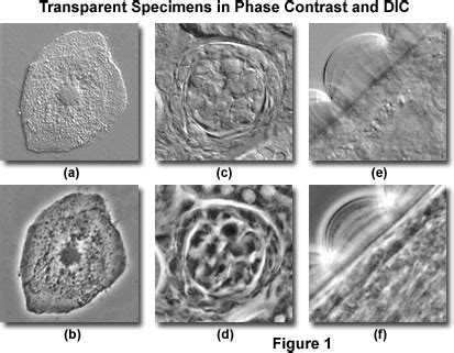 Differential Interference Contrast - Comparison of Phase Contrast and ...