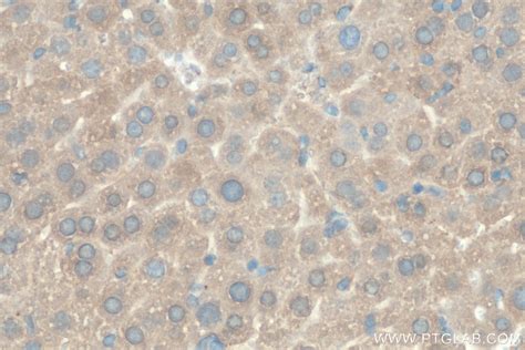 TPP1 antibody 12479 1 AP Proteintech 武汉三鹰生物技术有限公司