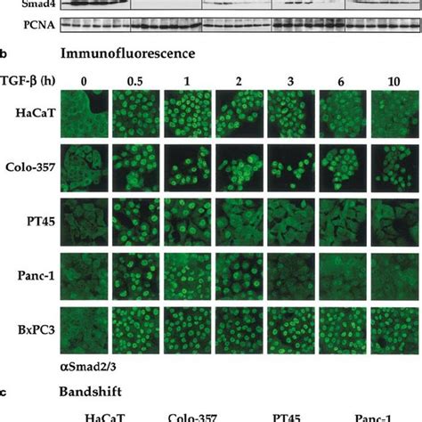 The Tgf B Smad Signaling Pathway Is Attenuated In Pt And Panc