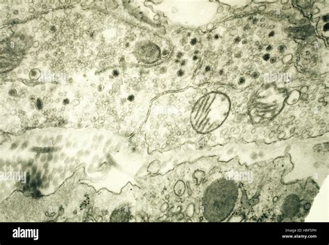 Chemical synapse micrograph hi-res stock photography and images - Alamy