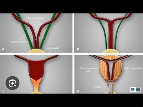 Development Of Uterus Fallopian Tube Vagina Female Genital Tract Embryology YouTube
