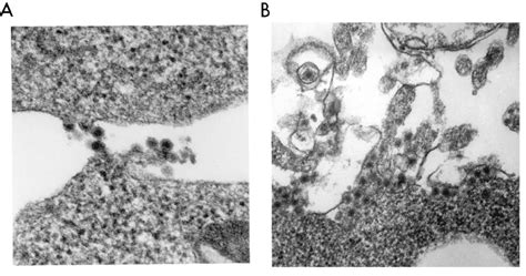 Electron microscopy analysis. Ultrastructure analysis of thin sections ... 