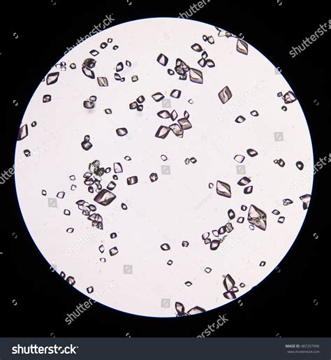 Uric Acid Crystal Urine Sediment Stock Photo 487297996 Shutterstock