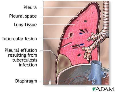 Respiratory Disorders Part 4 Flashcards Quizlet