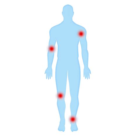 What is the Difference Between Tendonitis and Bursitis? - High Mountain ...