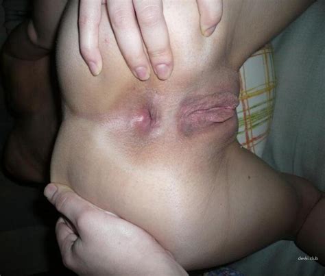 Amazing Assholes Porn Pic