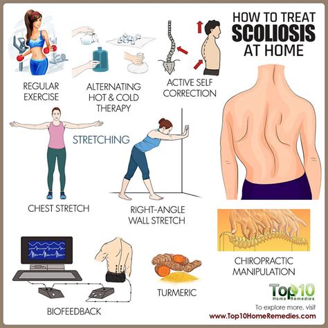 How To Treat Scoliosis Scoliosis Top 10 Home Remedies Home Remedies