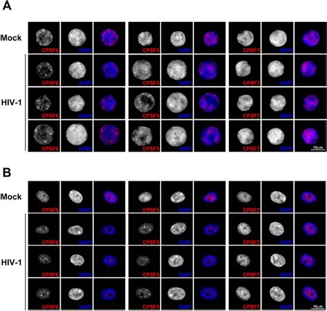 HIV 1 Infection Induces The Formation Of CPSF6 And CPSF5 Condensates In