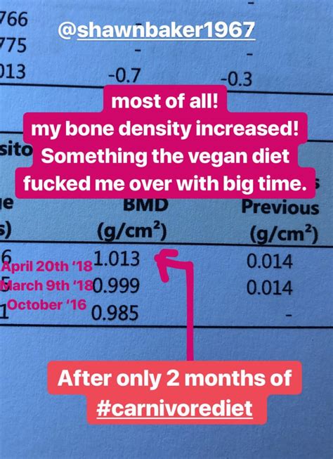 Dr Shawn Baker 🥩 On Twitter Can A Carnivore Diet Improve Bone Mineral