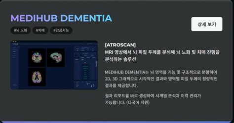 이슈 제이엘케이 ‘뇌경색 진단 Ai기기 첫 비급여 적용뇌졸중 시장서 매출 증가 기대 팍스경제tv