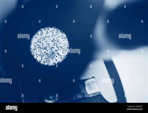 a molecule of gonorrhea through a microscope Stock Photo - Alamy