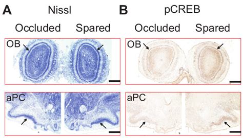 A Lateralized Odor Learning Model In Neonatal Rats For Dissecting