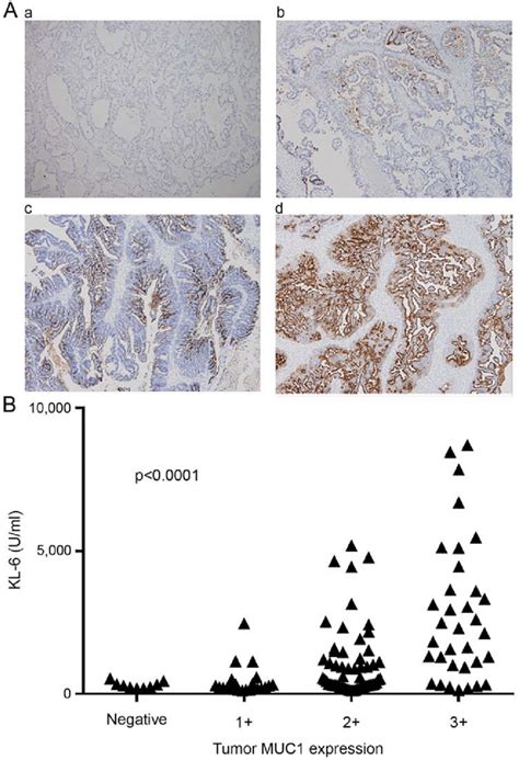 A Immunohistochemical Staining Of Tumor Muc Expression In Ovarian