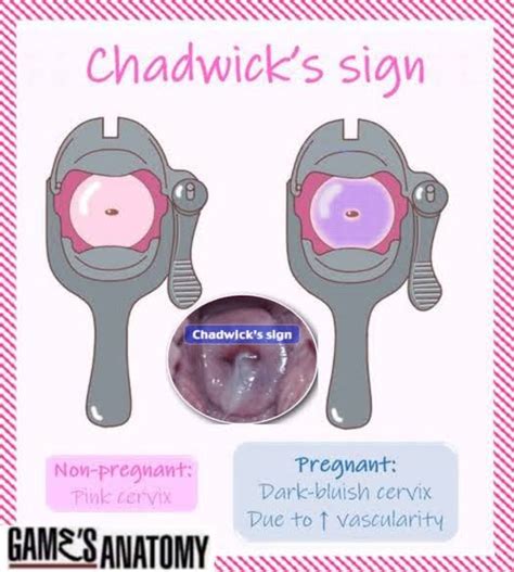 Chadwicks Sign