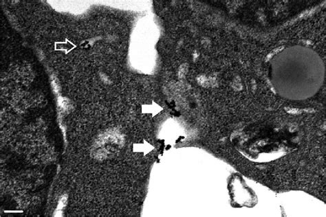 Interactions Between SPIONs And Cells TEM Micrograph Showing JK Cells