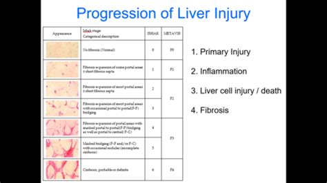 Liver Disease + Metabolism Flashcards | Quizlet