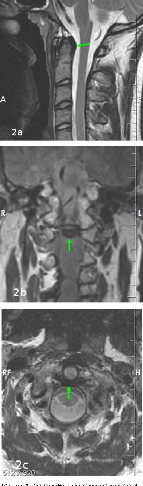 Figure 2 From Magnetic Resonance Imaging Of The Ligaments Of The